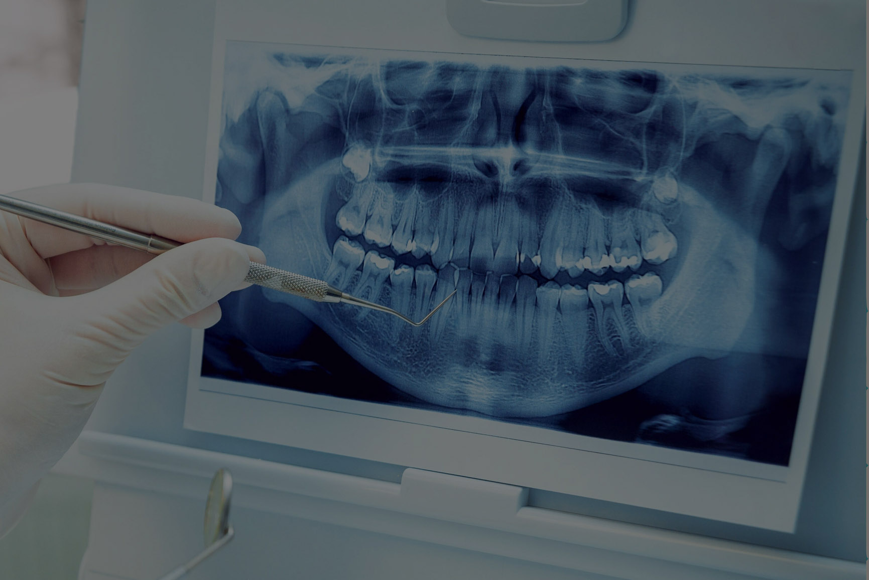 Radiologie Digitală 3D RXCT